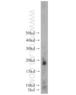 TFF2 Polyclonal antibody proteintech 13681-1-AP