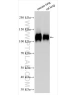 Integrin Beta 1/CD29 Polyclonal antibody proteintech 26918-1-AP