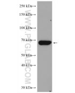 CHEK2 Polyclonal antibody proteintech 13954-1-AP