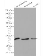CLPP Polyclonal antibody proteintech 15698-1-AP