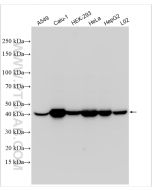 HLA class I ABC Polyclonal antibody proteintech 15240-1-AP