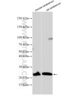 CLEC2L Polyclonal antibody proteintech 31928-1-AP