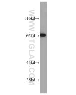 MEF2C Polyclonal antibody proteintech 10056-1-AP