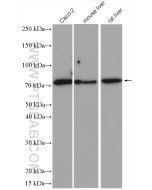 ABCG5 Polyclonal antibody proteintech 27722-1-AP