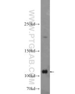 ADAR1 Polyclonal antibody proteintech 14330-1-AP