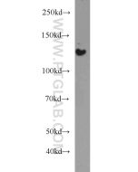 HDAC5-specific Polyclonal antibody proteintech 16166-1-AP