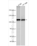 RB1 Polyclonal antibody proteintech 30373-1-AP