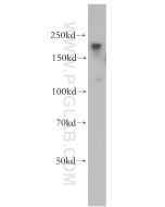 ZCCHC11 Polyclonal antibody proteintech 18980-1-AP