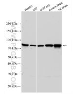 ACSS2 Polyclonal antibody proteintech 16087-1-AP
