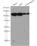 CD107b / LAMP2 Polyclonal antibody proteintech 27823-1-AP