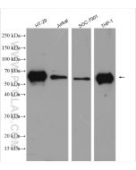 RIPK3 Polyclonal antibody proteintech 17563-1-AP