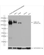 CD31 Polyclonal antibody proteintech 11265-1-AP