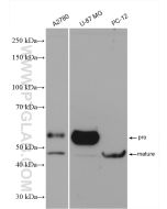 MMP3 Polyclonal antibody proteintech 17873-1-AP