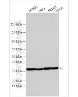 CTGF Polyclonal antibody proteintech 25474-1-AP