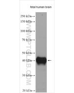 DCX Polyclonal antibody proteintech 13925-1-AP