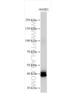 Pentraxin 3 Polyclonal antibody proteintech 13797-1-AP