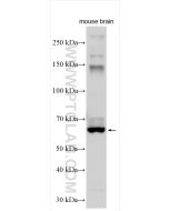 GPR161 Polyclonal antibody proteintech 13398-1-AP