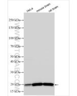 KRAS Polyclonal antibody proteintech 12063-1-AP