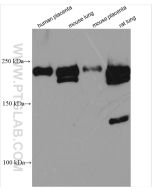 VEGFR2/KDR Polyclonal antibody proteintech 26415-1-AP