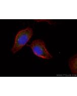 FBF1 Polyclonal antibody proteintech 11531-1-AP
