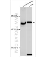 CD206 Polyclonal antibody proteintech 18704-1-AP