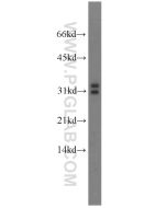 MARCH8 Polyclonal antibody proteintech 14119-1-AP