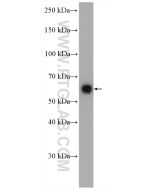MAOA Polyclonal antibody proteintech 10539-1-AP