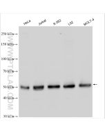 WTAP Polyclonal antibody proteintech 10200-1-AP
