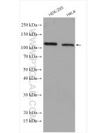 DGCR8 C-terminal Polyclonal antibody proteintech 10996-1-AP