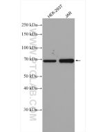 HGF Polyclonal antibody proteintech 26881-1-AP