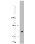 ATF4 Polyclonal antibody proteintech 10835-1-AP