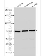 Cannabinoid receptor 1 Polyclonal antibody proteintech 17978-1-AP