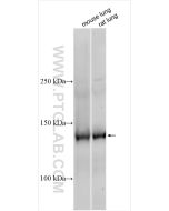 Tie-2/CD202b Polyclonal antibody proteintech 19157-1-AP