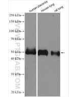 IL-1RL1/ST2 Polyclonal antibody proteintech 11920-1-AP