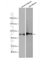 HSL Polyclonal antibody proteintech 17333-1-AP