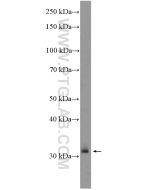XBP-1U specific Polyclonal antibody proteintech 25997-1-AP