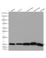 NDUFB8 Polyclonal antibody proteintech 14794-1-AP