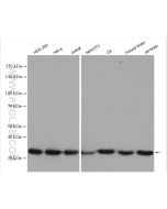 GAPDH Polyclonal antibody proteintech 10494-1-AP