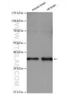 OLIG2 Polyclonal antibody proteintech 13999-1-AP
