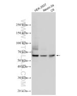 SMAD4 Polyclonal antibody proteintech 10231-1-AP