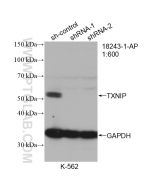 TXNIP Polyclonal antibody proteintech 18243-1-AP