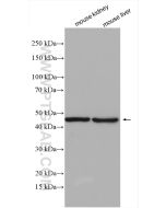 ACADL-Specific Polyclonal antibody proteintech 17526-1-AP