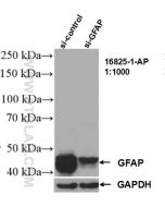 GFAP Polyclonal antibody proteintech 16825-1-AP