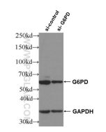 G6PD Polyclonal antibody proteintech 25413-1-AP