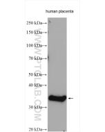 GDF8/Myostatin Polyclonal antibody proteintech 19142-1-AP