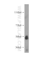 UGT2B4 Polyclonal antibody proteintech 15425-1-AP
