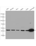 NDUFV1 Polyclonal antibody proteintech 11238-1-AP