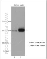 NKCC1/SLC12A2 Polyclonal antibody proteintech 13884-1-AP