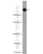 BRCA1 Polyclonal antibody proteintech 22362-1-AP