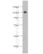 USP36 Polyclonal antibody proteintech 14783-1-AP